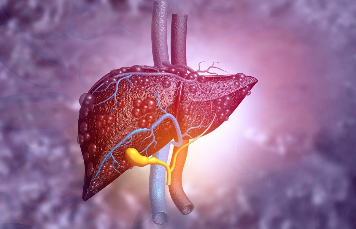 Therapeutic potential of caper bush in metabolic dysfunction-associated diseases